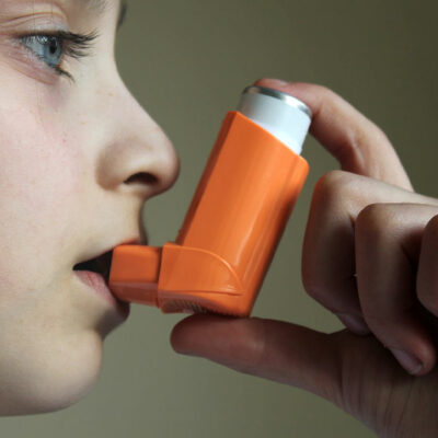 Here’s Why These 5 Cities Have the Most Asthma Cases
