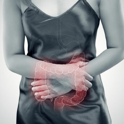 Symptoms and Trigger Foods for Ulcerative Colitis