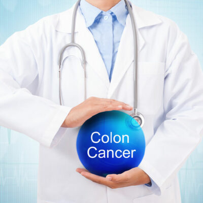 5 Early Incidcators of Colon Cancer